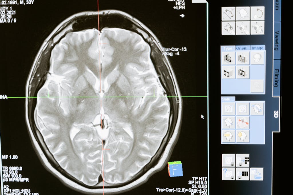 Intricate MRI brain scan displayed on a computer screen for medical analysis and diagnosis.